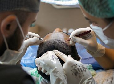 hair-transplant-7518352_1280